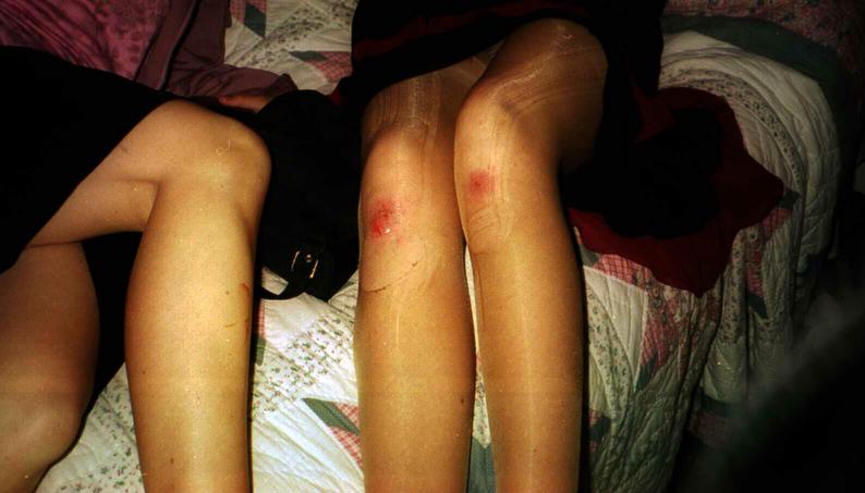 Injuries